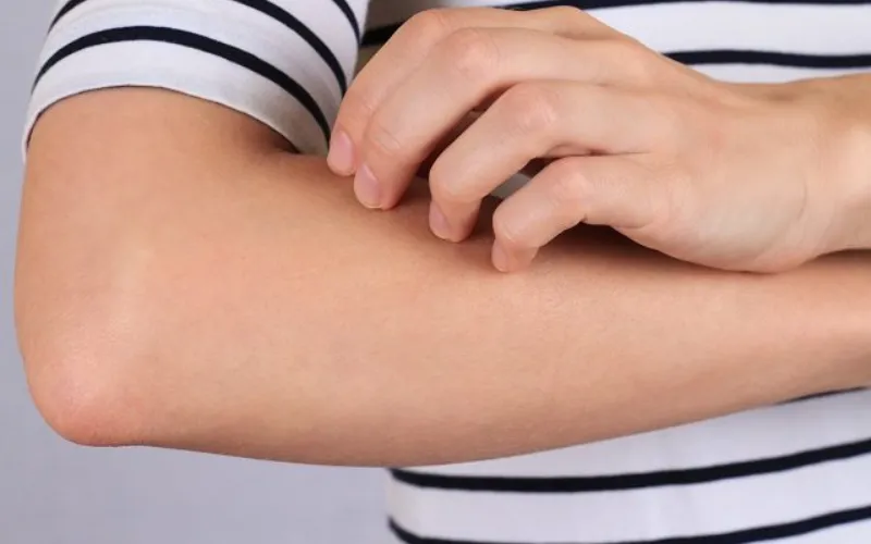 Tại sao bông thủy tinh gây ngứa​? Cách xử lý và phòng tránh