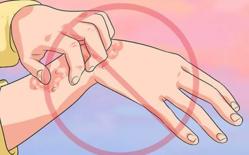 sợi thủy tinh gây ngứa