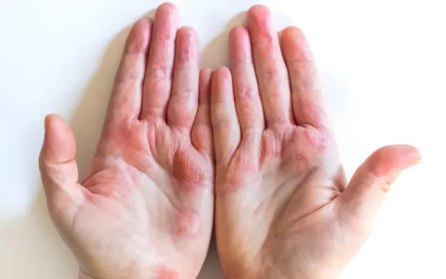 Bông thủy tinh có độc hại không? Tác hại của sợi thủy tinh