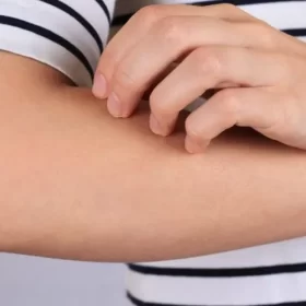 Tại sao bông thủy tinh gây ngứa​? Cách xử lý và phòng tránh